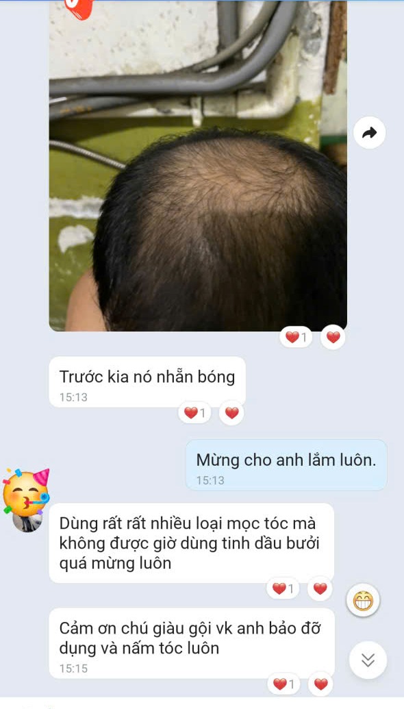 Customer photo of hair regrowth after using pomelo essential oil